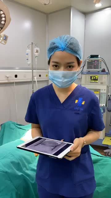 KẾT QUẢ 2 CA NÂNG CẤP VÒNG 1 VỚI DÒNG TÚI NANOCHIP EG