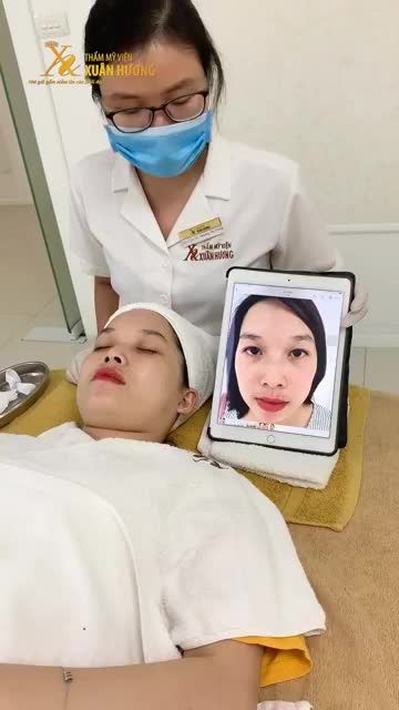 DA NÁM VÀ TÀN NHANG HỖN HỢP MỜ TỚI 80% CHỈ SAU 1 BUỔI TRỊ LIỆU ĐẦU TIÊN