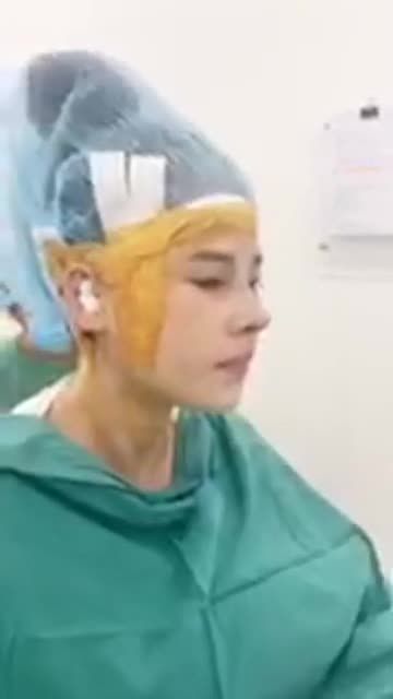 Khách hàng sóng mũi thấp, đầu mũi to, cánh mũi bè, đầu mũi nghiêng phải.