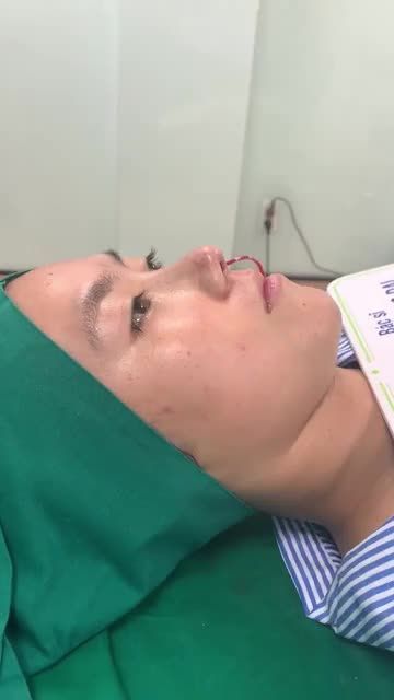 MŨI BÁN CẤU TRÚC SLINE SIÊU TỰ NHIÊN