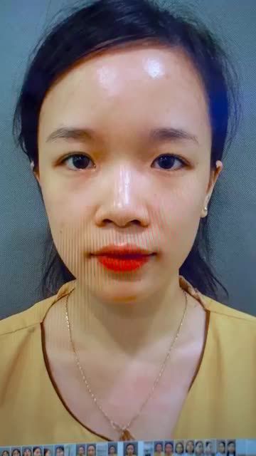 Tại sao hàng nghìn khách hàng chọn Dr.Hải Lê thực hiện cắt mí/ Sửa mí mời bạn cùng theo dõi video sau đây để có câu trả lời.!
