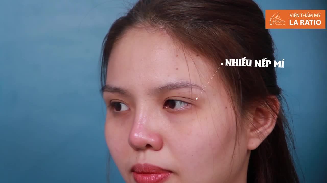 Hãy cùng theo dõi quá trình La Ratio thay đổi đôi mắt cho chị ấy như thế nào nhé !