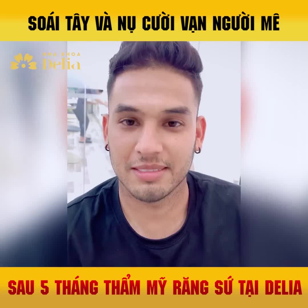Tái khám sau 5 tháng Thẩm mỹ răng sứ, Soái tây Ankor Rohilla - Chuyên viên Yoga cảm nhận như thế nào