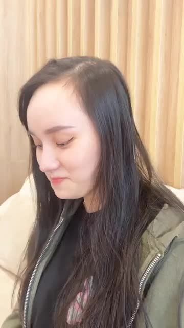 Khách hàng tái khám 4 tháng xinh quá mọi người ơi