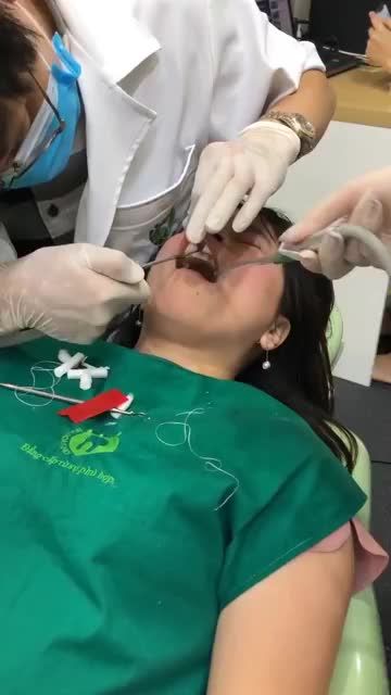 PHỤC HÌNH RĂNG NHIỄM MÀU VỚI DÁN SỨ VENEER