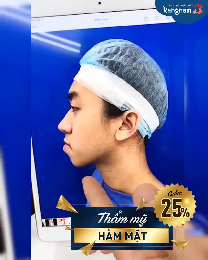 Chỉnh HÀM MÓM - Hóa "Hot boy" là có thật