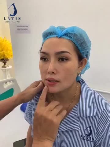 CẰM SỬA LẠI cho khách từng làm nơi khác không thành công