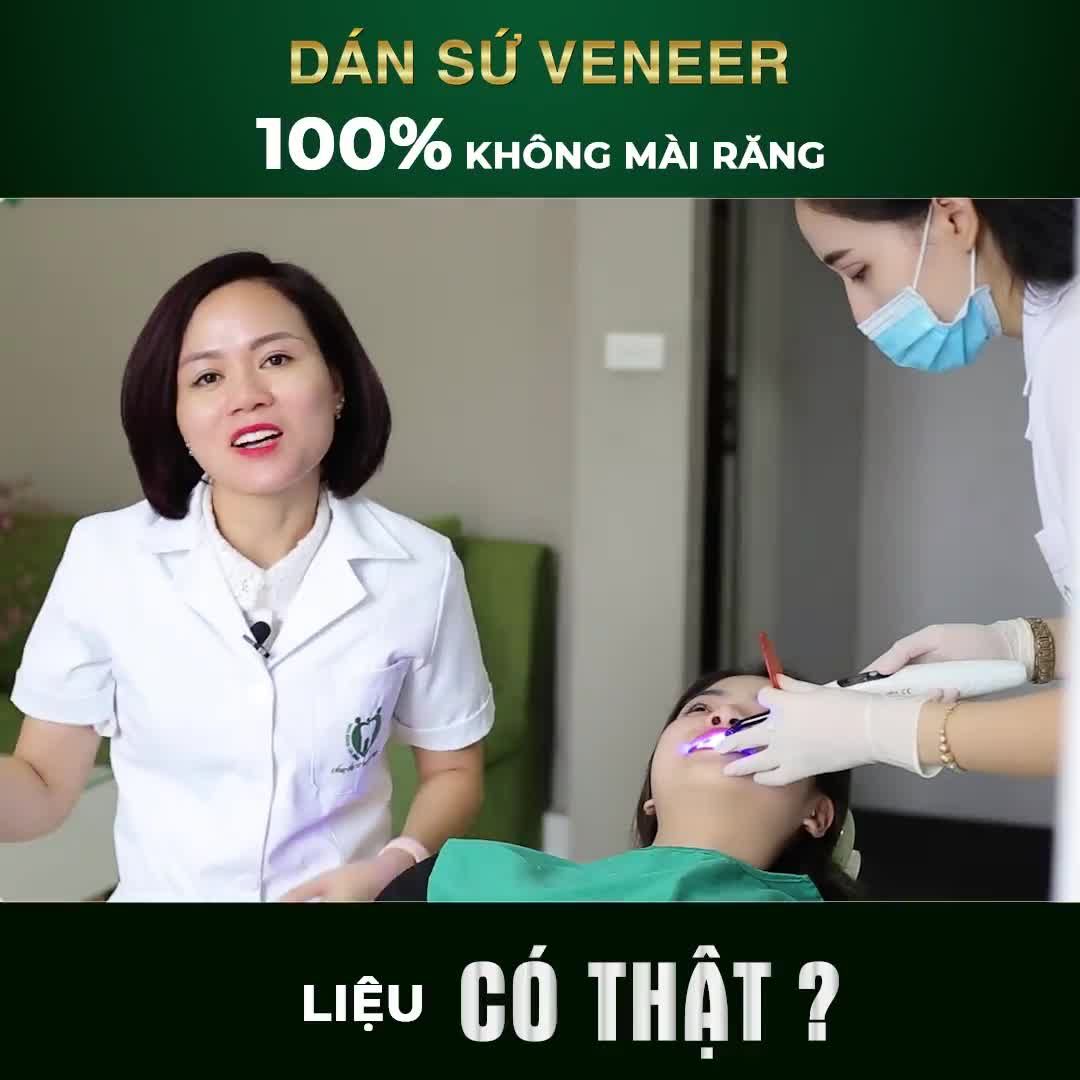 THỰC HƯ DÁN SỨ VENEER 100% KHÔNG MÀI RĂNG