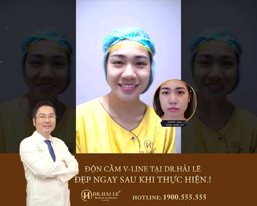 ĐỘN CẰM V-LINE TẠI DR.HẢI LÊ - ĐẸP NGAY SAU KHI THỰC HIỆN.!!!