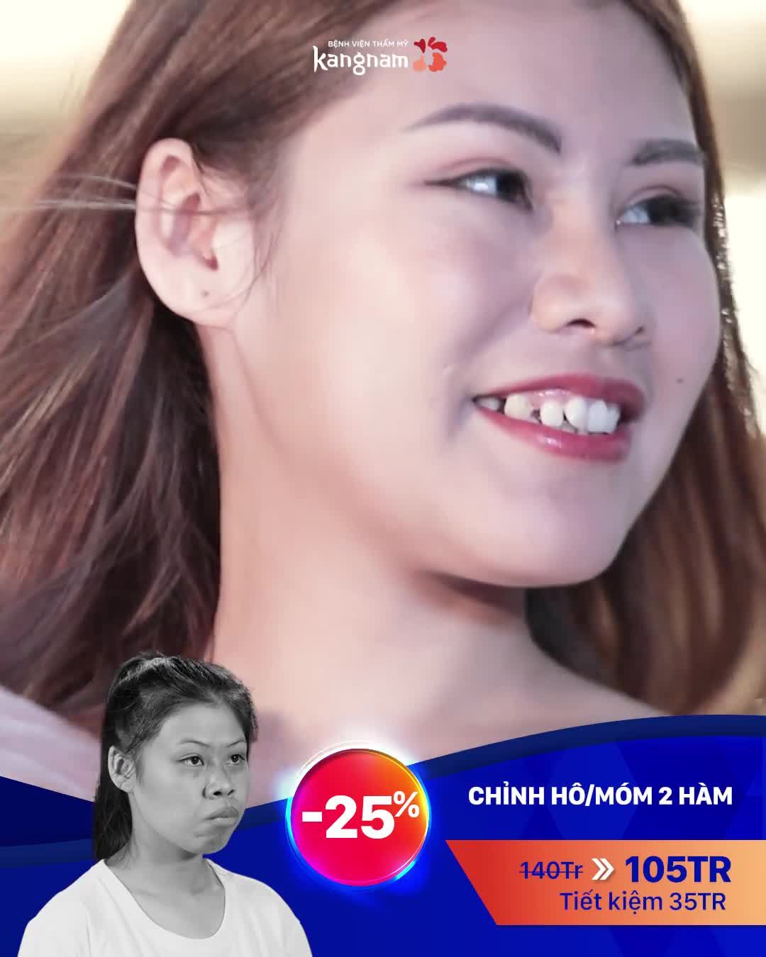 Thẩm mỹ hàm mặt giá tốt OFF tới 25%