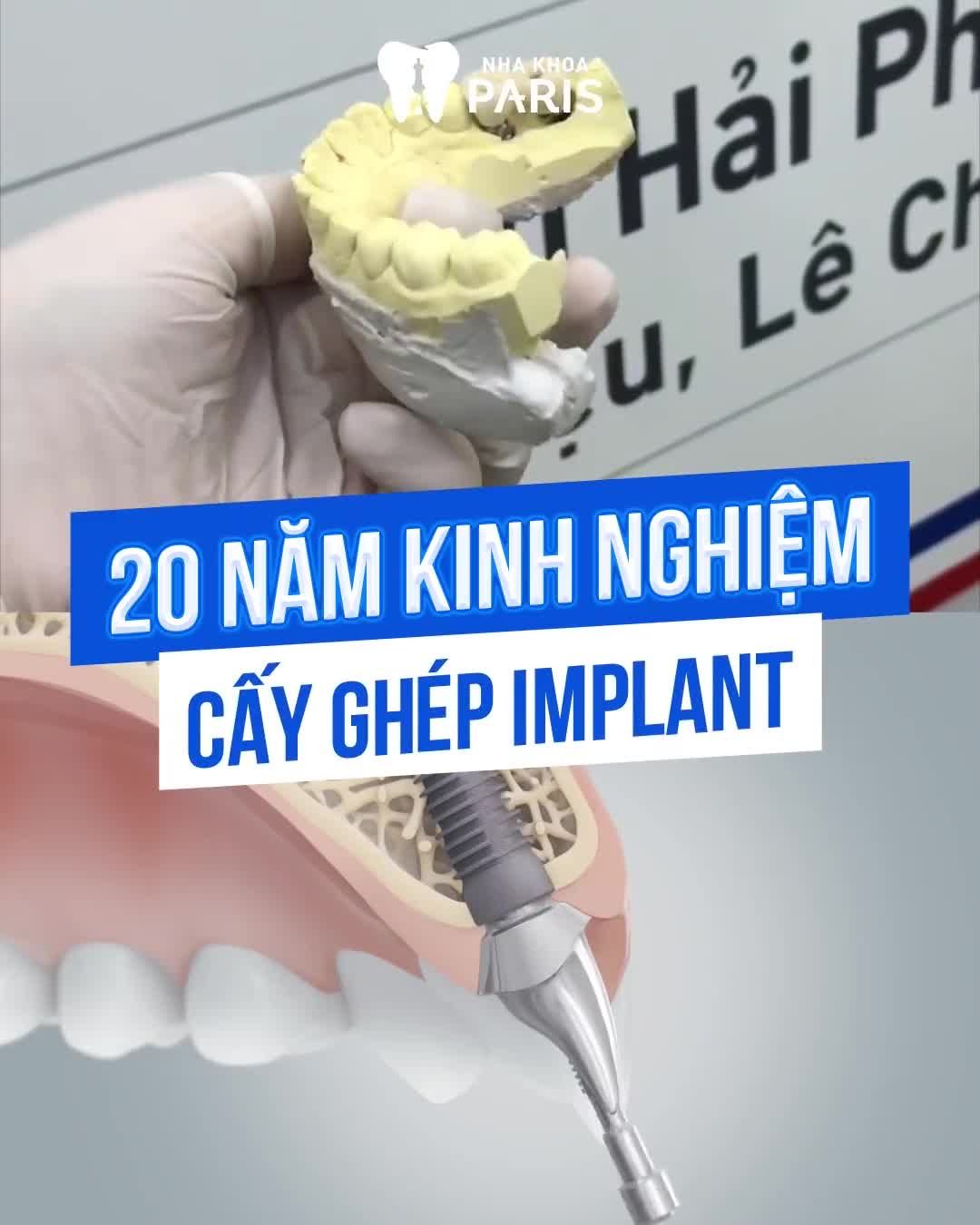 KHÁCH HÀNG BỌC RĂNG SỨ
