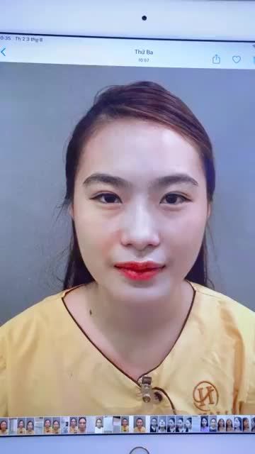 Nếp mí sau 7 ngày Sửa mí DeepTech20 trông sẽ như thế nào? Mời quý khách hàng cùng tham khảo qua clip sau đây.!