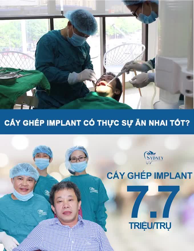 NHỮNG ĐIỀU CẦN BIẾT VỀ TRỒNG IMPLANT CHO NGƯỜI ĐANG MẤT RĂNG