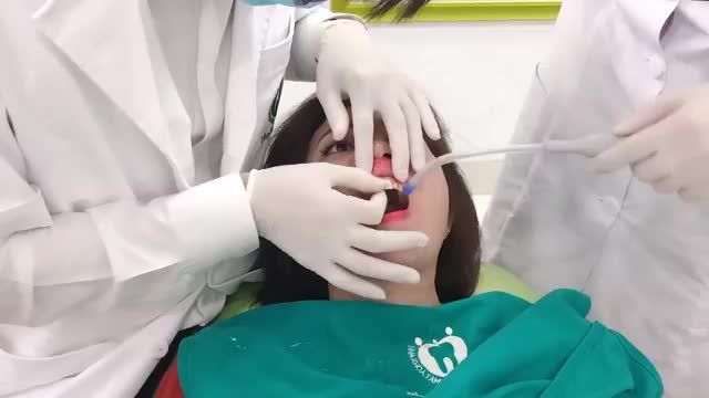 ƯỚM THỬ VENEER SỨ TẠI NHA KHOA GIA ĐÌNH