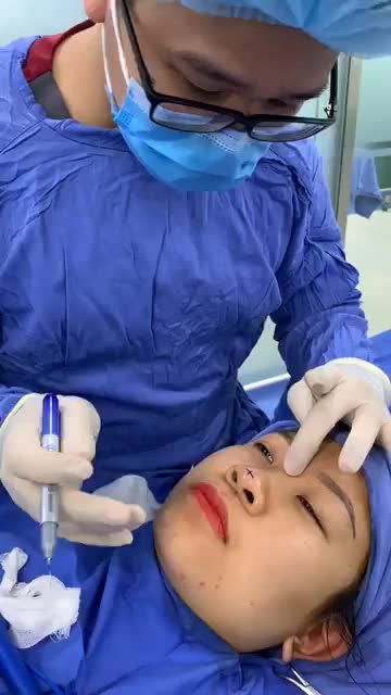Quy trình nâng mũi Cấu trúc 4D - chỉnh hình toàn diện mũi.