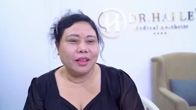 Vị khách hàng trẻ ra 5 - 10 tuổi, xóa bỏ tình trạng da dư sụp mí chỉ nhờ Nâng cung mày mời quý khách hàng cùng theo dõi.