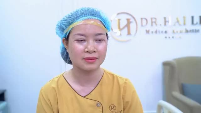 Combo Cắt mí dưới loại bỏ bọng mỡ gây nặng mắt + Nâng cung mày loại bỏ da dư chùng gây sụp mí.