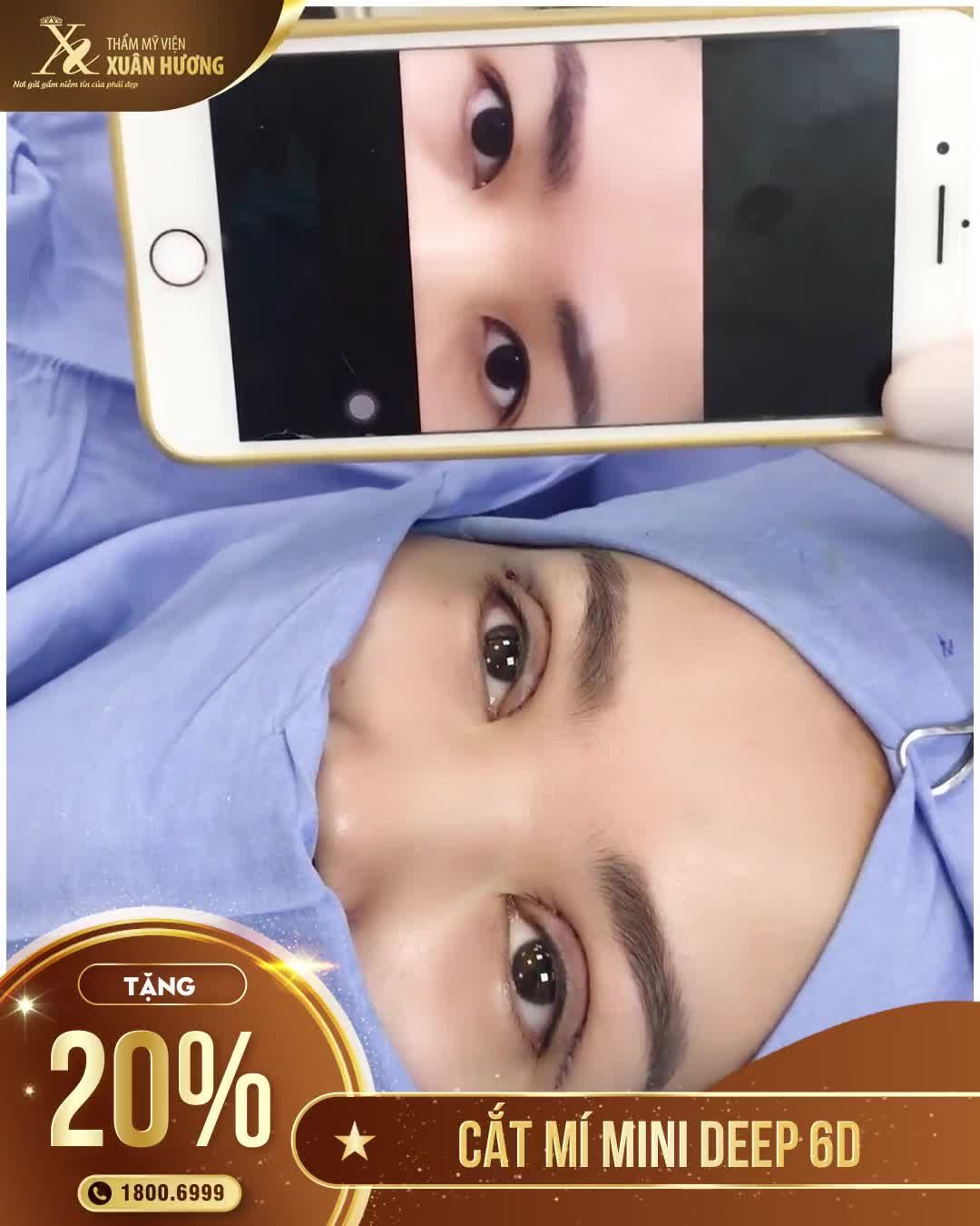 NẾP MÍ ĐỀU, ĐẸP XUẤT SẮC NGAY KHI VỪA CẮT MÍ MINIDEEP TẠI TMV XUÂN HƯƠNG