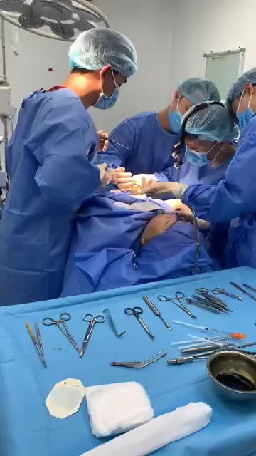 Khám phá Quy trình lấy "sụn sườn" cho khách hàng nâng mũi 100% sụn sườn
