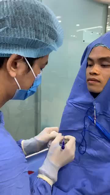 Khám phá Quy trình đo vẽ CHỈNH HÌNH SỤP MÍ cho khách hàng
