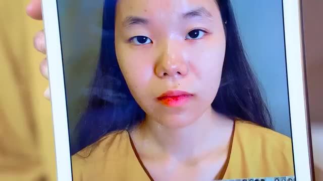 Khi nào bạn cần can thiệp Cắt mí để thay đổi giúp đôi mắt to rõ nét ấn tượng trẻ trung hơn?