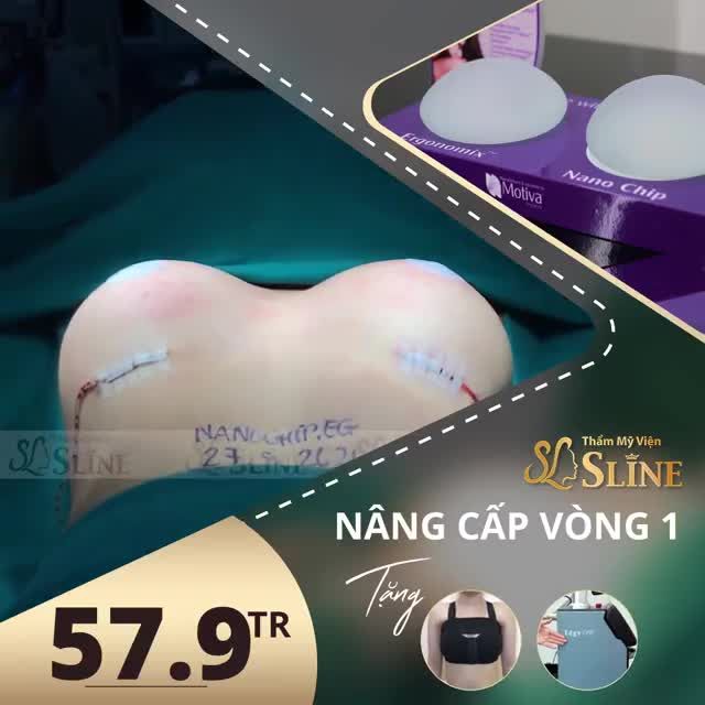 TẠM BIỆT VÒNG 1 PHẲNG THẬT DỄ DÀNG KHI ĐẾN VỚI SLINE