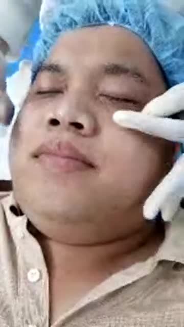 MỤN THỊT quanh MẮT MÁ CỔ