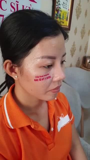 NÂNG MŨI BÁN CẤU TRÚC 2 LỚP ĐẸP HOÀN HẢO