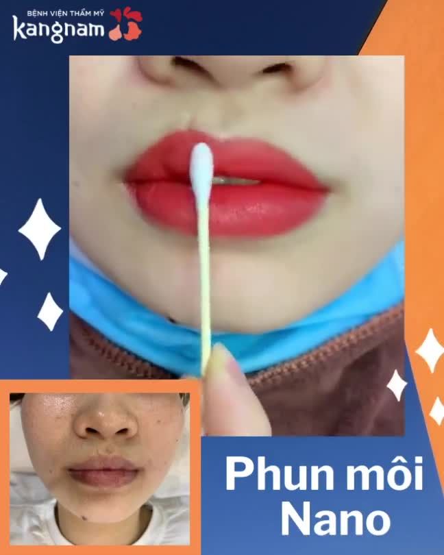 Phun MÔI xong mà môi không hề sưng  Đích thị là Phun môi NANO rồi
