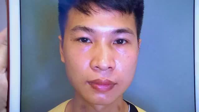 Bác sĩ làm việc xuyên trưa mang đến đôi mắt 2 mí to rõ nét cho khách hàng nam giới - Mời quý khách hàng cùng theo dõi.