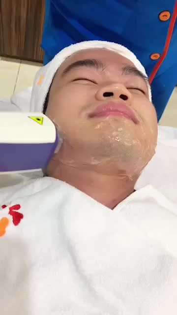 Triệt râu vĩnh viễn cho nam giới với công nghệ laser Hiệu quả 85% sau liệu trình