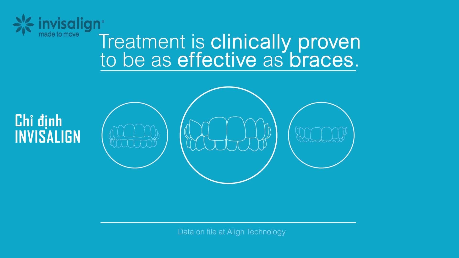 NIỀNG RĂNG INVISALIGN: CHỈ ĐỊNH VÀ TÍNH HIỆU QUẢ