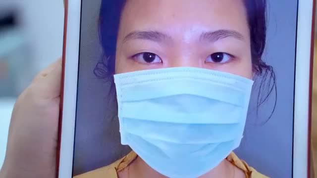 Cắt mí kết hợp mở góc mắt khắc phục tình trạng mắt một mí, khe mắt hẹp. Sau 30 phút, sở hữu đôi mắt 2 mí to tròn, tươi trẻ "vạn người mê".