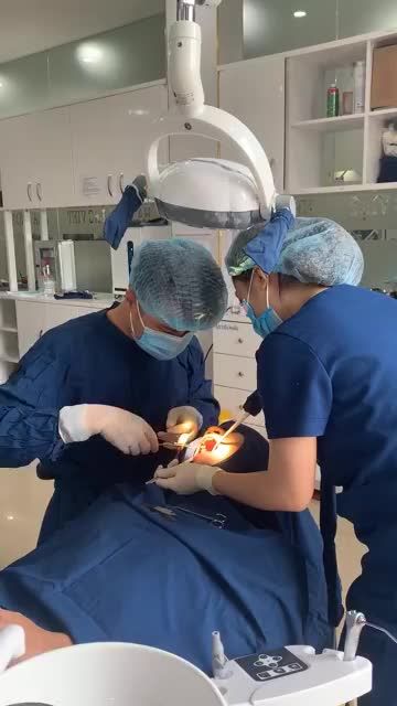 CẤY GHÉP IMPLANT TRỤ STRAUMAN ACTIVE TẠI LẠC VIỆT INTECH