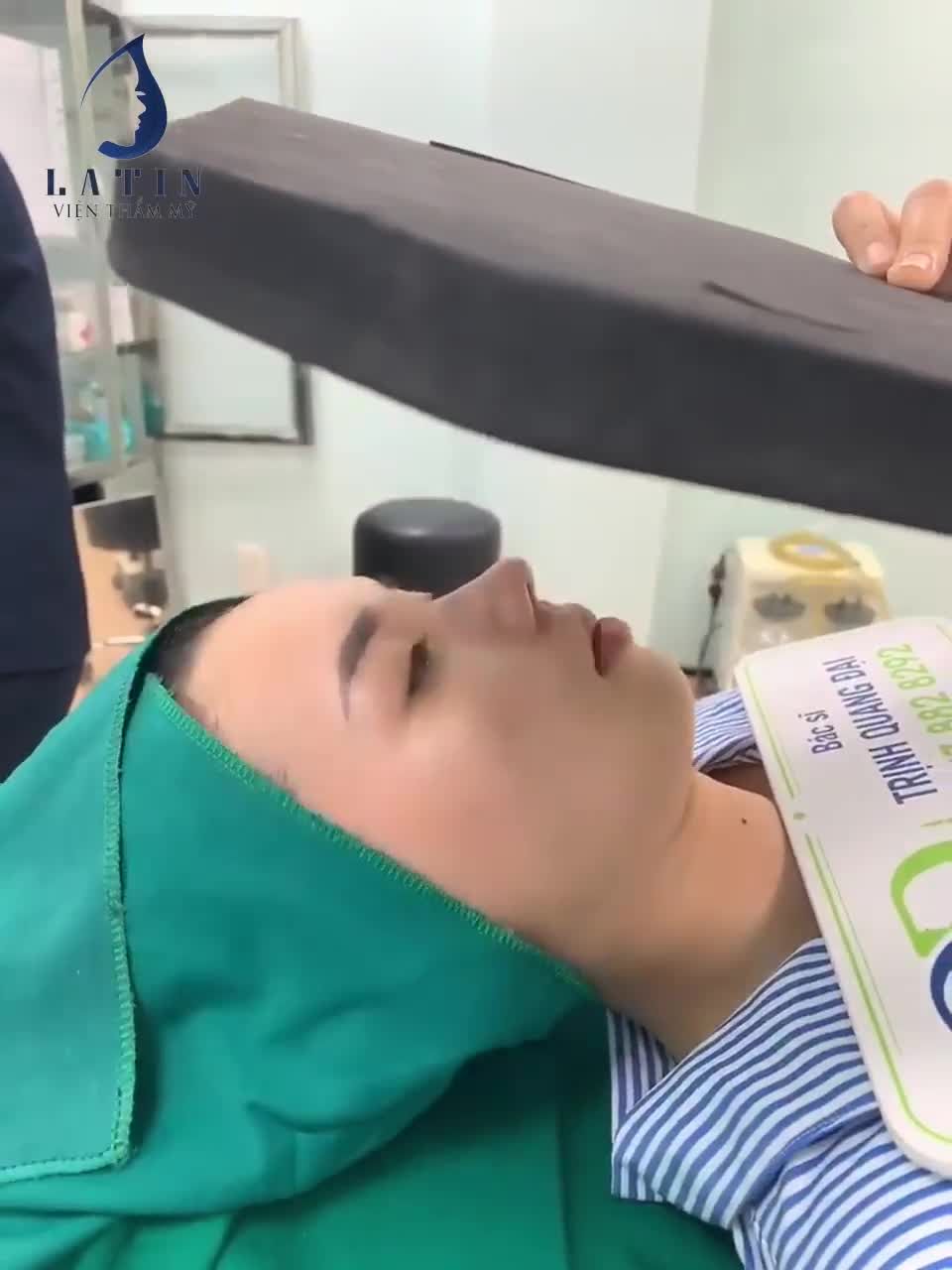 MŨI CẤU TRÚC XỬ LÝ NỀN XƯƠNG MÀI GỒ