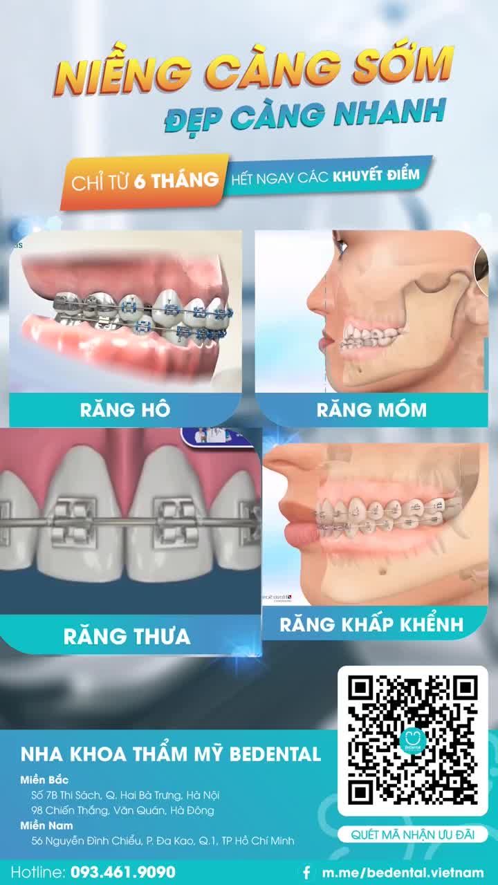 NIỀNG RĂNG CÀNG SỚM ĐẸP CÀNG NHANH