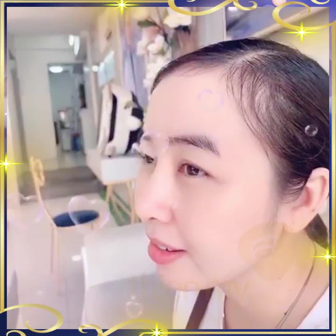 Phương pháp nâng mũi cấu trúcThiện Mỹ là giải pháp thần thánh