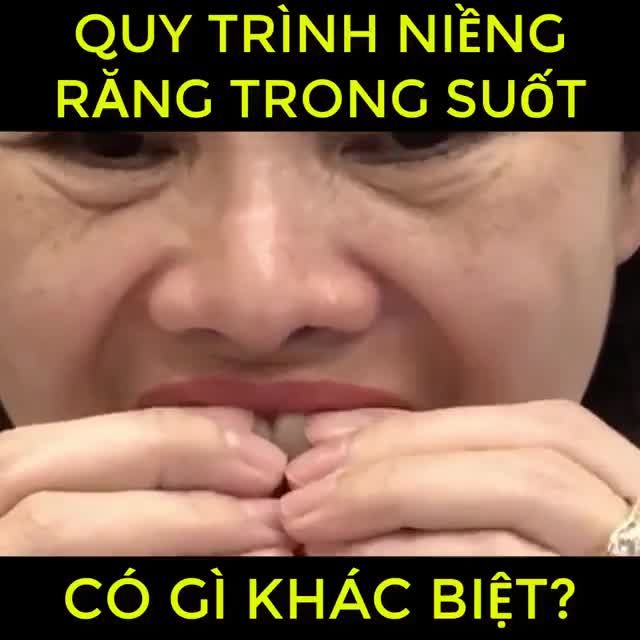 QUY TRÌNH NIỀNG RĂNG TRONG SUỐT CÓ GÌ KHÁC BIỆT?