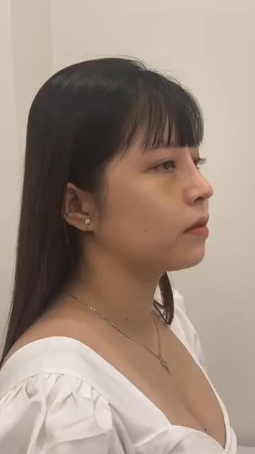 "Tân trang" dáng mũi cùng bác sĩ Đỗ Quang Khải