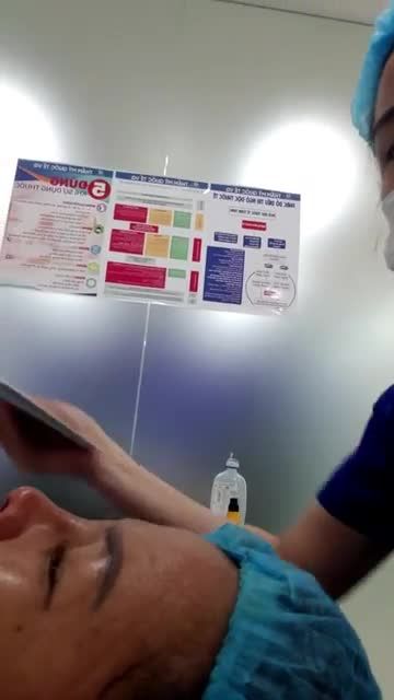 Kết quả sau 2h nâng mũi cấu trúc Sofline plus của Dr Vũ Quang và Ekip