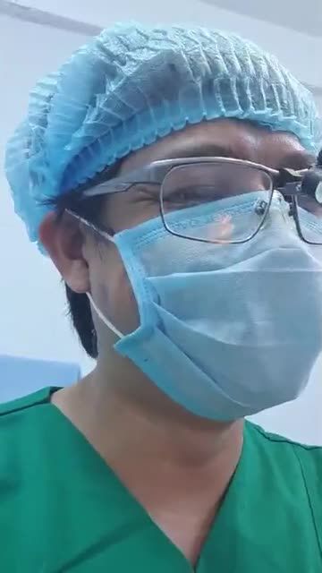 Nâng mũi cấu trúc 2 lớp