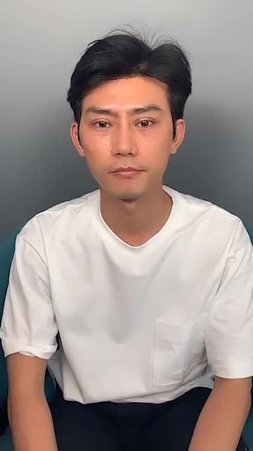 Tái khám sau một tháng Nâng mũi cấu trúc + Cắt mí Hàn Quốc