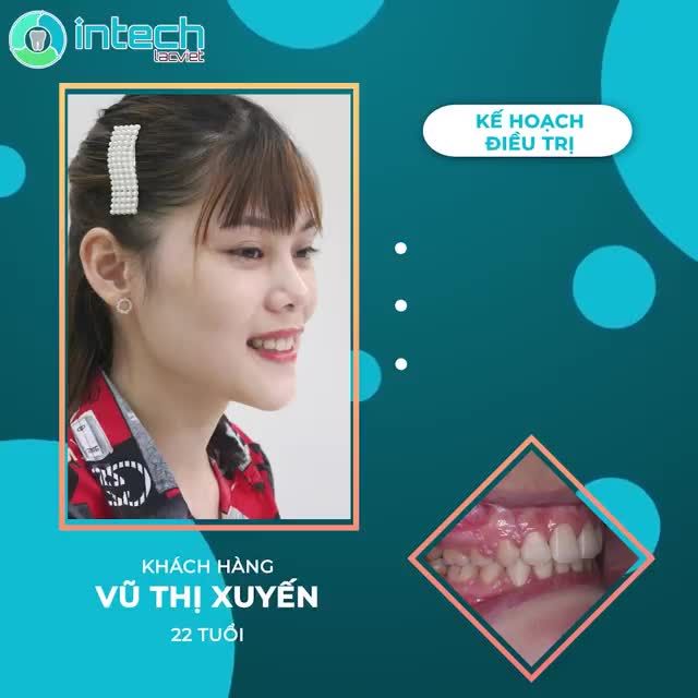 THAY ĐỔI NỤ CƯỜI - THAY ĐỔI THẦN THÁI