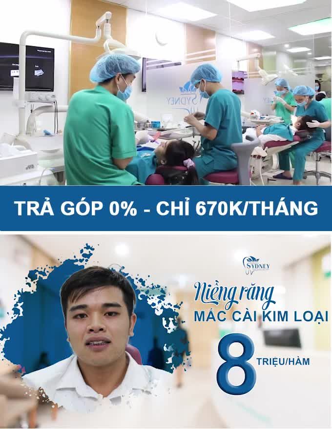 VÌ SAO MẮC CÀI KIM LOẠI PHÙ HỢP VỚI HẦU HẾT CÁC TRƯỜNG HỢP RĂNG CẦN CẢI THIỆN