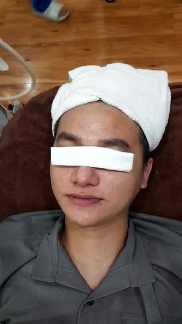 Quy trình chiếu đèn sau khi lấy nhân mụn cho khách hàng thực hiện lần thứ 6.