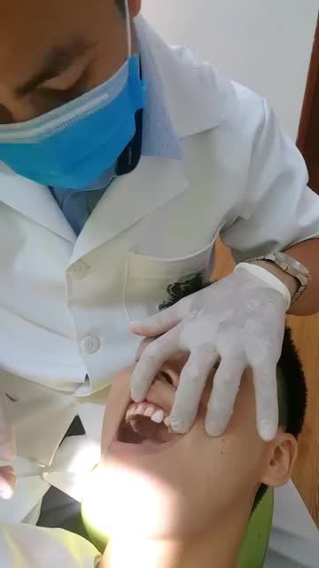 DÁN SỨ VENEER – KỸ THUẬT BẢO TỒN RĂNG THẬT TỐT NHẤT HIỆN NAY