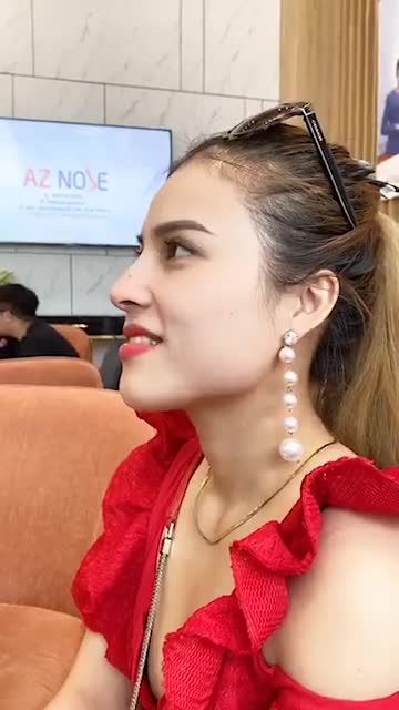 Feedback thật của khách hàng nâng mũi tại AZ sau 1 tháng
