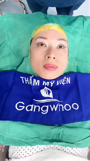 Một đôi MẮT HÀN QUỐC cực kì có hồn vào form ngay sau khi làm đảm bảo không sưng không bầm