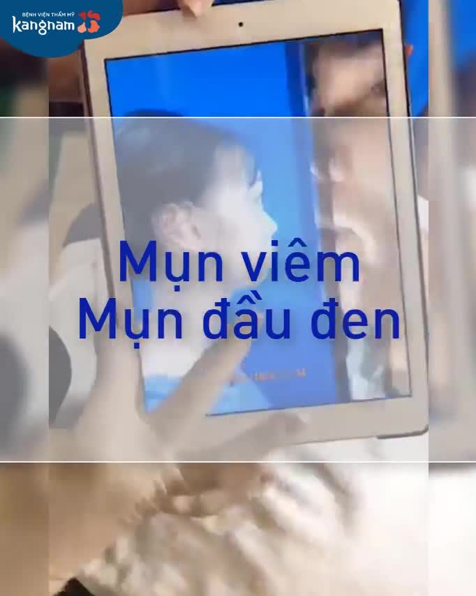Thoát MẶT MỤN, hóa "soái ca" sau 10 BUỔI điều trị