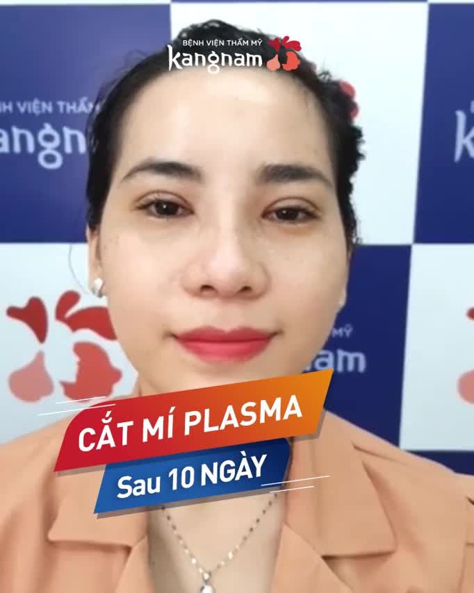 Từ MÍ LÓT thành 2 MÍ long lanh như này Chỉ MẤT 10 NGÀY